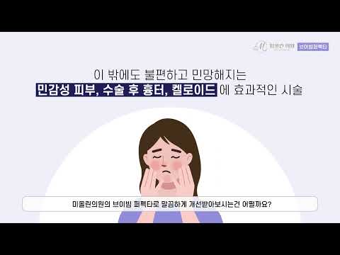 브이빔 퍼펙타