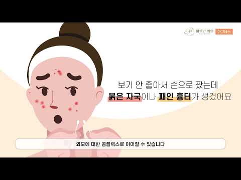 Agnes Video