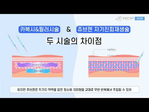 쥬브젠 자가진피재생술