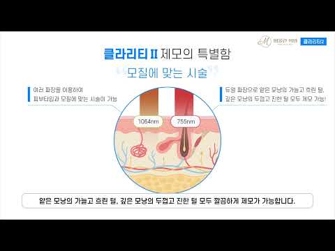 클라리티2 레이저 제모