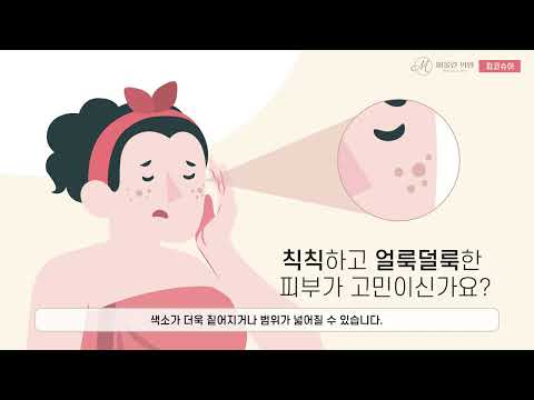 피코슈어 레이저