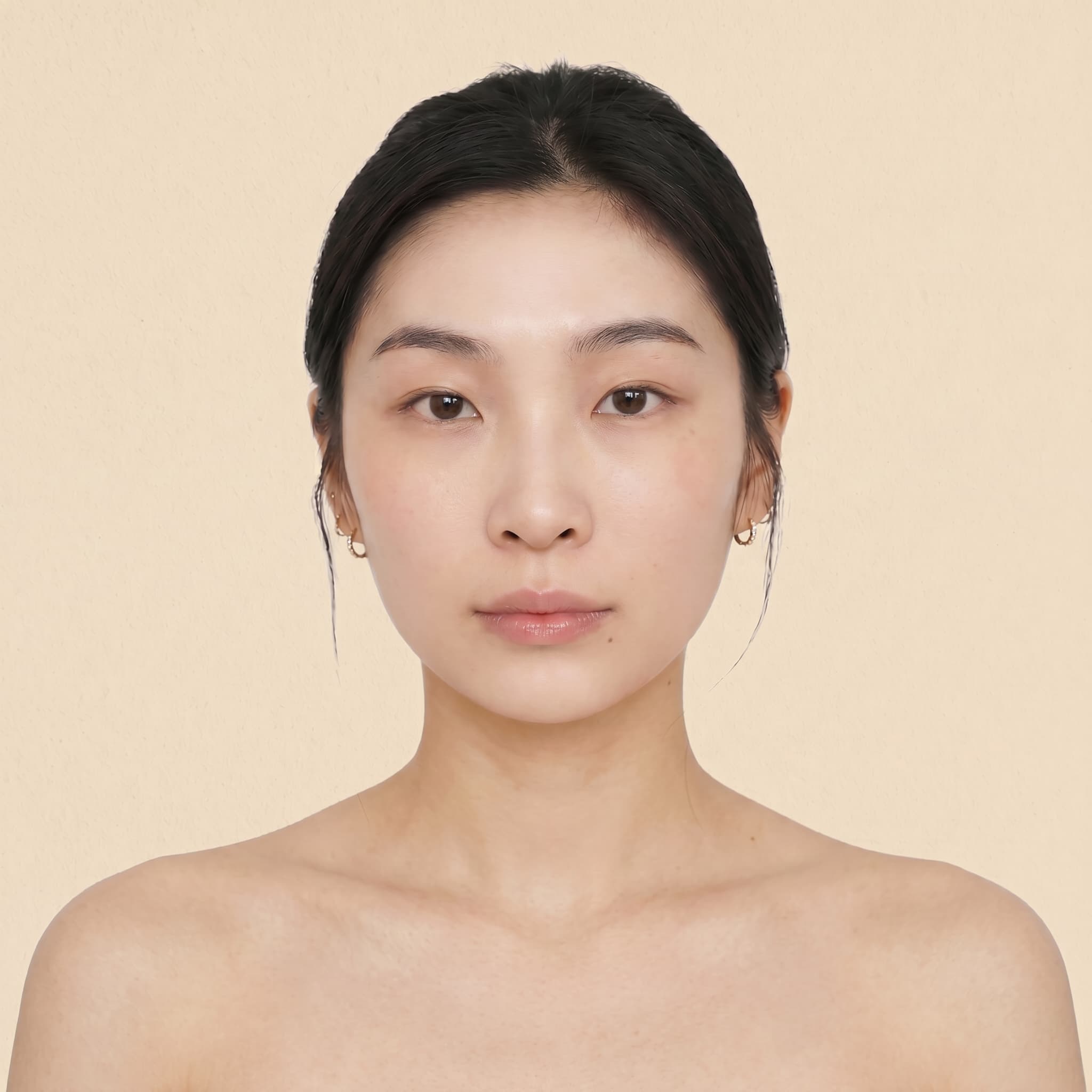 피지샘 선택적 파괴