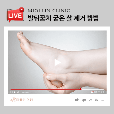 발뒤꿈치 굳은살 제거법 보습이 중요!