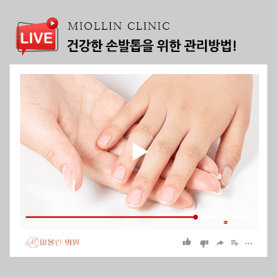 건강한 손발톱을 위한 관리방법, 여름철이라면 더욱 주의!