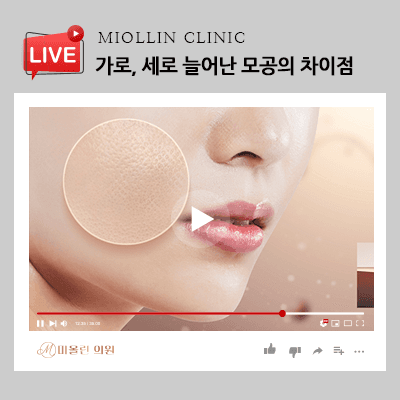 가로, 세로 늘어난 모공의 차이점에 대해 알아봐요!